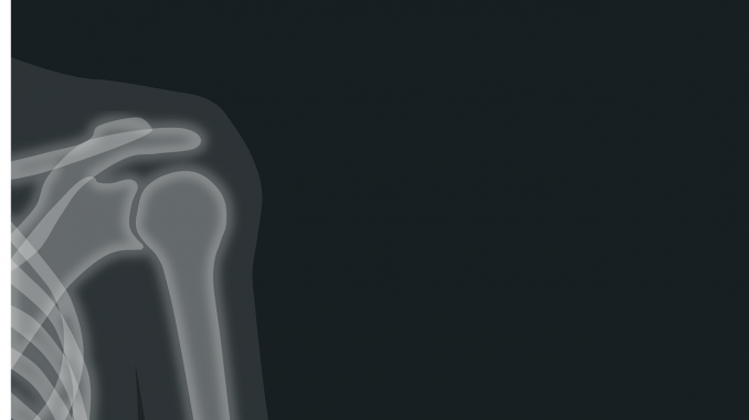 x-ray-1884888_1280